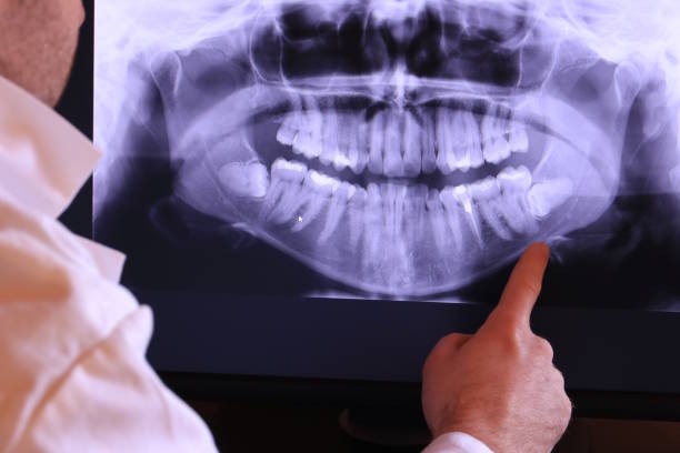 Best Broken or Chipped Tooth Repair in Reminderville, OH